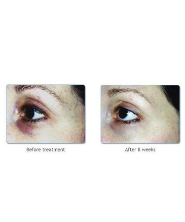 Anti Aging Eye Cream | Anti Wrinkle & Eye Care 15ml - LOVELY EYES by Elaine Perine | Made in Germany - Buy Online on GoSupps.com
