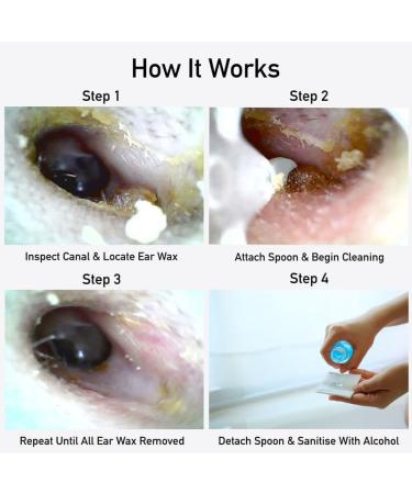 EarScope Ear Cleaner Wireless Otoscope with Camera & LED Light Ear Wax Removal Kit for All Ages Best Ear Care Products for iPhone & Android - Buy Online on GoSupps.com