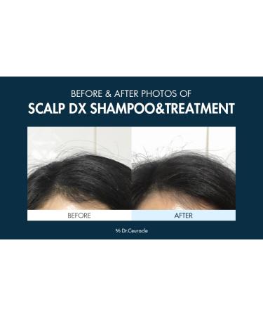 Dr.Ceuracle Scalp DX Voluming Treatment | Anti-Hair Loss Volume Care | Intensive Hair Mask with Collagen and Keratin | Strengthen Scalp Hair | leegeehaam Cosmetics - Buy Online on GoSupps.com