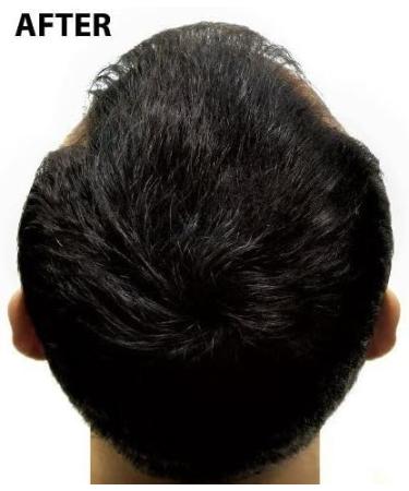 Super Million Hair - 15g Hair Fibres - No.45 Medium Blonde - Buy Online on GoSupps.com