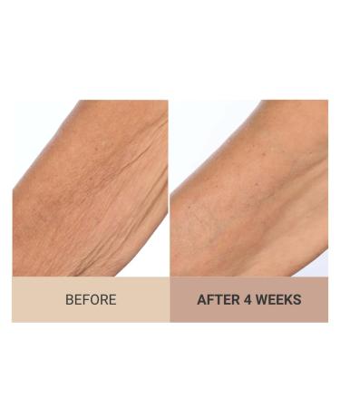 Consult Beaute Unscented Champagne Lift Hydrating Firming Body Cream with Pink Pepperslim Moisturizer Tightens Crepey Skin Tones & Hydrates Dry Skin on Arms & Legs - 8 oz. - Buy Online on GoSupps.com