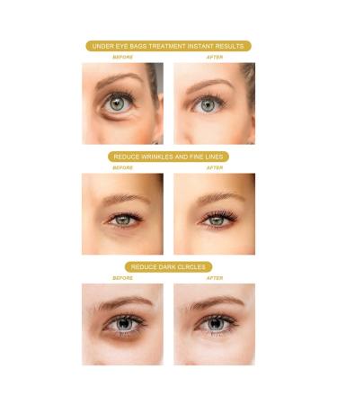 Under Eye Patches with Aloe Vera & Hyaluronic Acid | 60 Natural Moisturizing Masks for Dark Circles & Puffiness - Anti-Wrinkle Care (30 Pairs - Buy Online on GoSupps.com