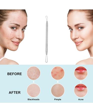 La Chat Professional Blackhead and Blemish Remover - Pimple Comedone Removal 2-in-1 Extractor Tool - Buy Online on GoSupps.com