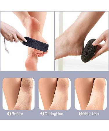 Natural Foot Pumice Hard Skin Remover for feet - Foot Scrub for Removing Dead Skin - Natural Foot File and Stratum corneum Remover for Removing Skin Keratin(Black) (2 Goose Shaped Stones) - Buy Online on GoSupps.com