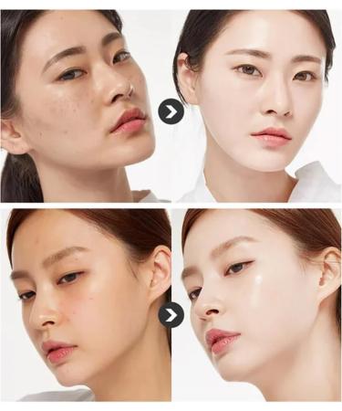WHITENING and Freckle-Removing Facial Cleanser Refreshing Oil Control Freckle Removal and Nicotinamide Brightening Skin Tone (Color : 2PCS) - Buy Online on GoSupps.com