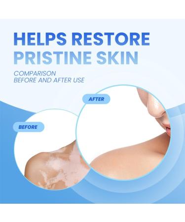 OIXYEY OIXEY 1 piece whitening cream natural plant extracts gently and effectively reduces white spots improves pigmentation suitable for all skin types 20 GB - Buy Online on GoSupps.com