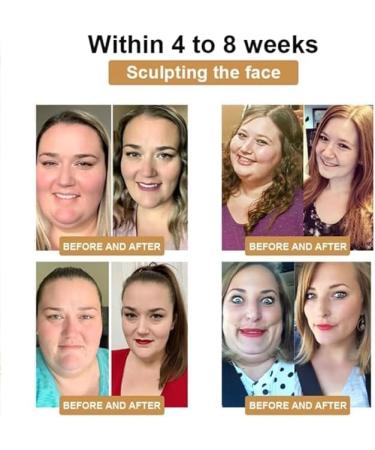 (Must effective) 5Box-50Pcs Bee Venom Lymphatic Drainage Slimming Patch | Bee Venom Slimming Patches for Women & Men | Suitable for Use by Individuals of All Ages - Buy Online on GoSupps.com