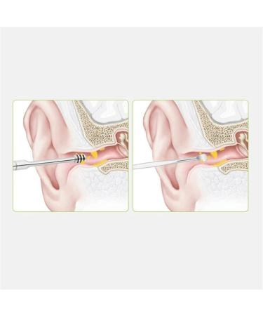 KouRy Portable Spiral Ear Pick - Soft Silicone & Stainless Steel Ear Cleaner Tool for Effective Wax Removal - Reusable Earpick Curette - Buy Online on GoSupps.com