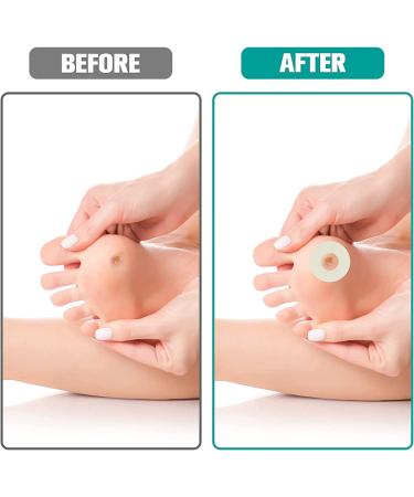 60 PCS Self Adhesive Callus Pads for Corn & Callus Remover - Pain Relief Toe & Heel Protectors - Buy Online on GoSupps.com