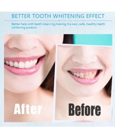 3D White Teeth Whitening Strips - Professional Whitening Treatment for Brighter Smiles - Buy Online on GoSupps.com