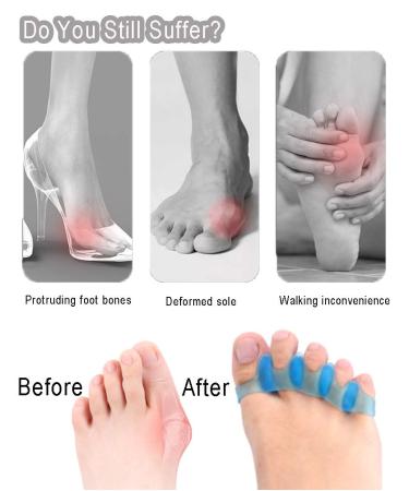 Alivonao Gel Toe Separators & Straighteners for Bunions, Hammer Toes - Universal Size (2 Pair) - Buy Online on GoSupps.com