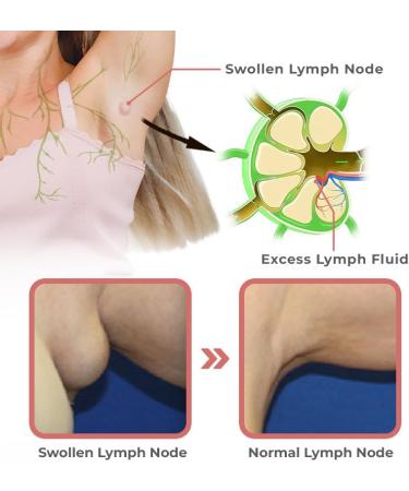 LymphFlow Magnetogen Earrings Fashion Lymphatic Germanium Earrings Lymph Flow Magnetogen Earrings for Weight Loss Lymphvity Magnetic Therapy Earrings (2pcs-Blue) - Buy Online on GoSupps.com