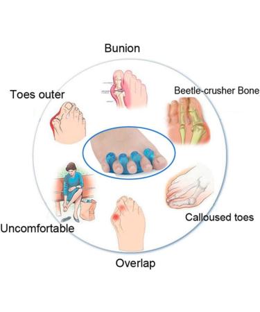 Buy Lysng Portable Toe Speech Correctors - Multifunctional Hammer Toe Relief for Hallux Valgus & Overlapping Toes | Pain Relief at Home & Travel - Buy Online on GoSupps.com