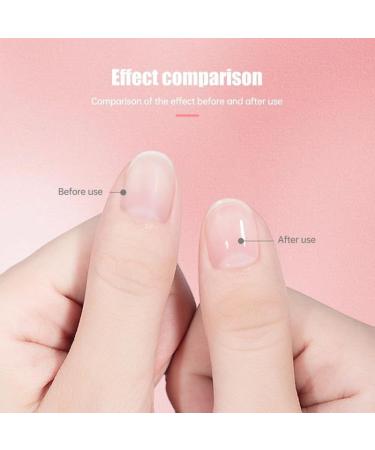 Radiant Cosmetics Nail Growth Oil Nail Oil for Growth and Strength (#4) - Buy Online on GoSupps.com