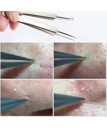 1Pc Professional Stainless Bend Curved Tweezer Blackhead Acne Clip Comedone Pimple Extractor Remover Tool for Comedone Whitehead Acne Blemish Bend ClipProfessional and Attractive - Buy Online on GoSupps.com