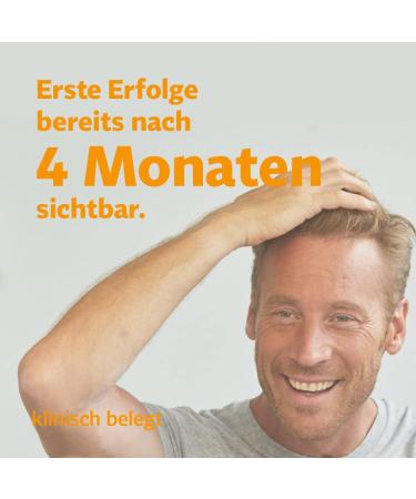 Minoxidil Bio-H-Tin 50 mg/ml Spray - Combat Hereditary Hair Loss | 3 x 60 ml + Gentle Care Shampoo (8 ml) - International Shipping Available - Buy Online on GoSupps.com