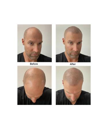 Plume Natural Instant Hairline Scalp Stick - Vegan Clean Beauty for Luscious Hair & Lashes (Blonde 1.5g) - Shop Internationally - Buy Online on GoSupps.com