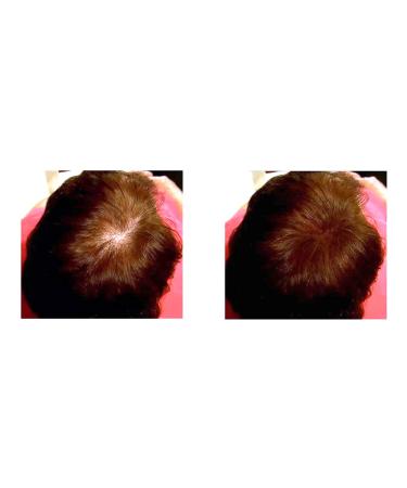 Caboki VALUE PACK 2 270-Day Supply Auburn - Buy Online on GoSupps.com