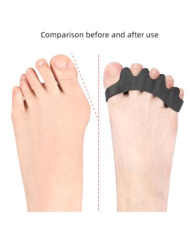 Toe Spreader & Bunion Corrector Gel - 2 Pairs Adjustable Toe Extensor for Hallux Valgus Plantar Fasciitis & Hammer Toe - Improve Toe Health - Buy Online on GoSupps.com