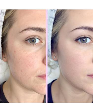 100% Organic 1.5% Hyaluronic Acid Cream Hydrating Anti-Aging & Sensitive Skin Moisturizer 50ml / 1.7 fl oz Natural Facial Cream for Deep Hydration Skin Repair and Gentle Nourishment. - Buy Online on GoSupps.com