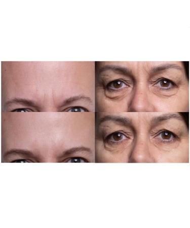 Botaxbee Venom Firming Serum Set Bee Venom Wrinkle Removal Serum Firming & Wrinkle-Reducing Cream For Face and Body Botax Bee Venom Firming Cream For Men & Women 2PCS - Buy Online on GoSupps.com