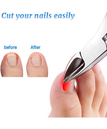 Toenail Clippers Nail Clippers Cuticle Clipper Ingrown Toenail Treatment Heavy Duty Nail Nippers Scissor for Fingernails Pedicure Paronychia for Men and Women Red (Color : Red) - Buy Online on GoSupps.com