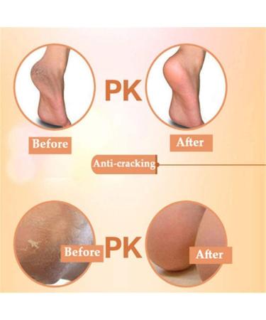 Buy 3 Pairs of Unisex Moisturizing Heel Socks | Spa Socks for Dry Cracked Feet Care | Breathable Heel Cushions for Soft Skin - Buy Online on GoSupps.com