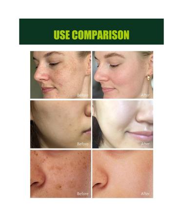 DISAAR Beauty Licorice Root Anti-Wrinkle Face Cream Hydrating Facial Skin Anti-Aging Moisturizer for Dark Spots & Fine Lines Evening 50g / 1.69fl.oz - Buy Online on GoSupps.com