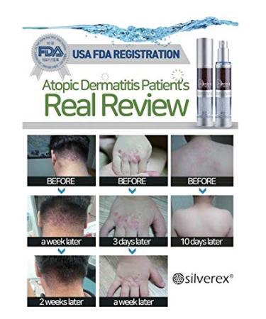 Buy Silveray-II Skincare Mist Spray - 99.99% Pure Silver Foam & Ceramic Balls for Ultimate Moisturizing | Colloidal Silver Water - International Shipping Available - Buy Online on GoSupps.com