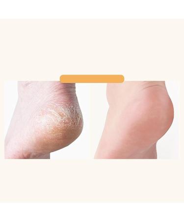  G n rique Horse Oil Foot Cream No Drying Hand Cream Healthy Smooth Feet Balm for Dry Skin Interactive and Natural Cracked Heel Hand Care Product 30g See Picture for More Details - Buy Online on GoSupps.com