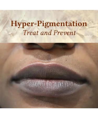 Mectix Lip Lightening for Dark Lips Lip Brightener for Smokers Dark Lip Treatment Lightening Cream for Pink Lips Lip Lightener for Smoker Lips Lip Lightening balm for Men and Women - Buy Online on GoSupps.com