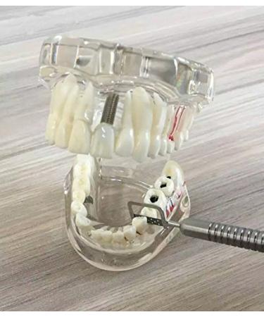 Buy Dental Reciprocating IPR System Kit - 5pcs Automatic Strips & Manual Handle for Orthodontic Use | International Shipping - Buy Online on GoSupps.com