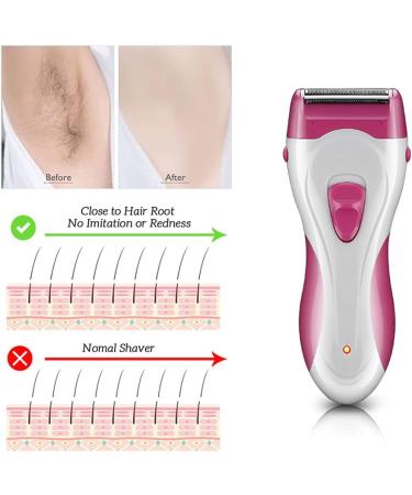 Advanced Wireless Women's Electric Razor - Painless Lady Shaver for Armpits Legs & Bikini | Wet/Dry Use - Buy Online on GoSupps.com
