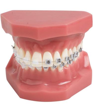 Dental Teeth Model - Orthodontic Study Tool with Metal & Ceramic for Demonstration - Buy Online on GoSupps.com