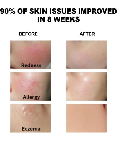 Wormwood Facial Oil - 100% Natural Essential Oils Moisturizing 10 mL | Shop Internationally - Buy Online on GoSupps.com