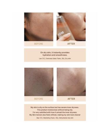 Elishacoy | Kombucha Glow Serum Mist 100 ml / 3.38 fl oz Fermented Kombucha + Peptide Glow Face Mist, Vegan Hydrating & Radiance Spray for All Skin Types/Best Moisturizer for Sensitive and Dry - Buy Online on GoSupps.com