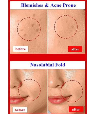 WHITESILK-wisely Stem Cell + Volufiline + Spicule Instant Night Shift Serum Pore Minimizer Skin Tightening Hydrating Dead Skin Cells Improvement (50ml 1.69oz) - Buy Online on GoSupps.com