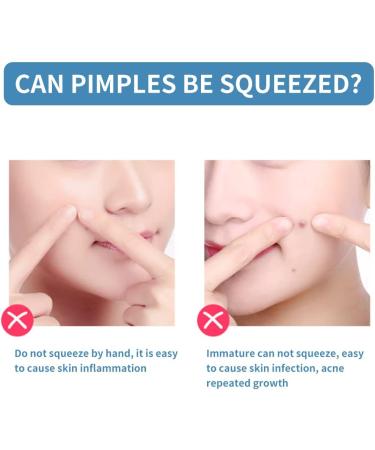 Stain Removal Tweezers & Blackhead Remover Tool | Stainless Steel Pore Cleaner for Perfect Skin - Buy Online on GoSupps.com