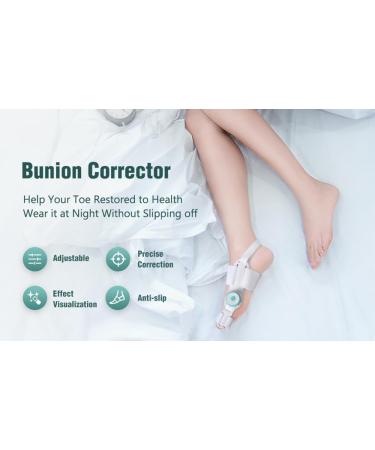 Adjustable Silicone Hallux Valgus Correctors - 2 Pieces for Left & Right Feet | Orthotic Solutions - Buy Online on GoSupps.com