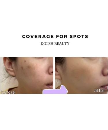Doleh Beauty Lokah Liquid Concealer - Full-Coverage, Waterproof, Long Lasting Formula for Undereye + Corrector, Covers Imperfections Naturally - Buy Online on GoSupps.com