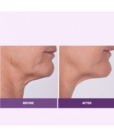 Serious Skincare Reverse Lift Firming Set - 4 Piece Facial Cream Correc-Chin Serum & Eye Cream - Firm Lift & Smooth Wrinkles - Lightweight Formula for All Skin Types - Buy Online on GoSupps.com