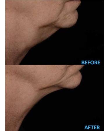 N.E.C.K Control: Neck Lifting Firming & Retracting Cream - Best Anti-Aging Solution for a Youthful Neck | Shop Now Internationally - Buy Online on GoSupps.com