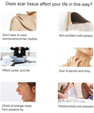 Delicate Skin Scar Treatment Serum - Acne Scar Removal & Repair Cream - 20ml - Buy Online on GoSupps.com