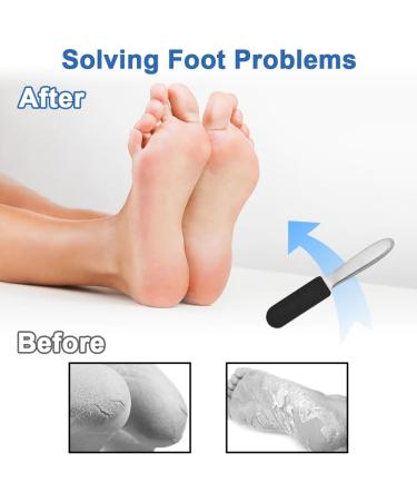 Foot File for Hardened or Dry Skin Stainless Steel Foot File with Replacement Sandpaper Coarse and Fine Stainless Steel Callus Rasp Callus File Foot Care Professional Callus File for Callus - Buy Online on GoSupps.com