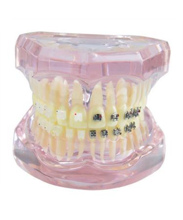 Tooth pattern dental orthodontic studio template dental oral model pattern demonstration of the pathological anatomy study