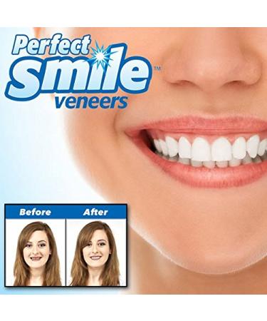 SHOP-STORY - Replacement tooth reusable removable Instant Perfect Smile Kit