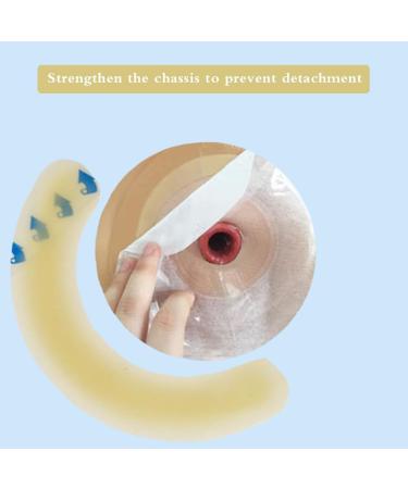 Shanzhinan 20PCS Ostomy Supplies | Elastic Barrier Strips for Colostomy Bags - International Shipping Available - Buy Online on GoSupps.com