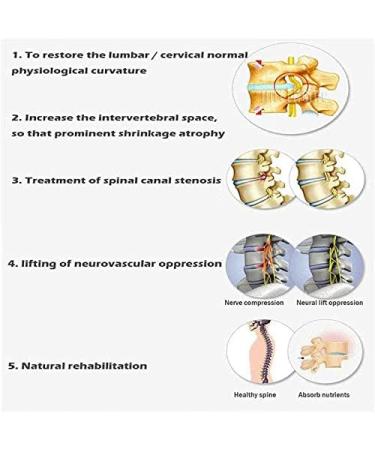 Back Traction Device Cervical Traction Bed Home Use Cervical Spine Extension Stretcher Device for Relieve Cervical Fatigue and Back Pain - Buy Online on GoSupps.com