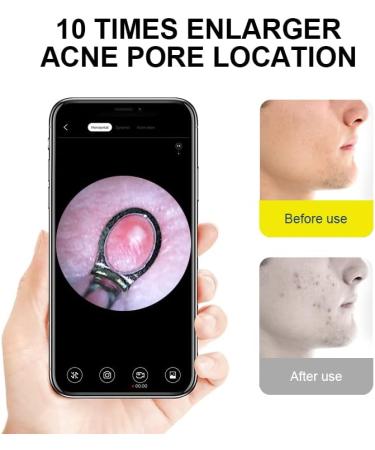 1080P FHD Wireless Ear Wax Camera & Cleaner Set - New Version for Kids, Adults, Pets - 6 LED Light Ear Wax Removal Tool - Black - Buy Online on GoSupps.com