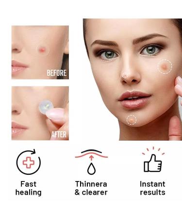 Tristar Beauty Magic Acne & Pimple Cover - 48 Patches for Fast Relief | International Shipping Available - Buy Online on GoSupps.com